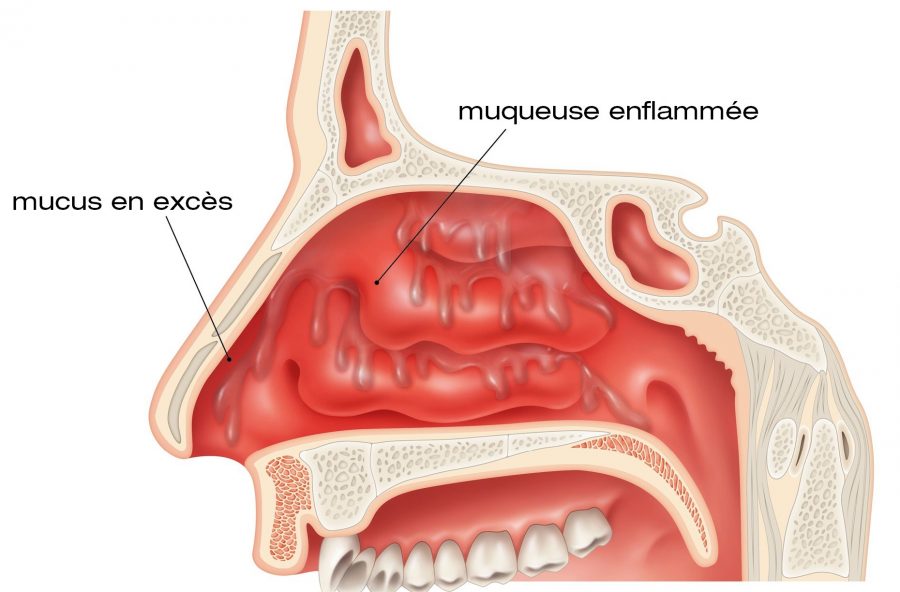 La morve dans toute sa splendeur ViruScience